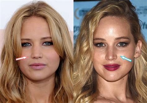 jennifer lawrence before nose job.